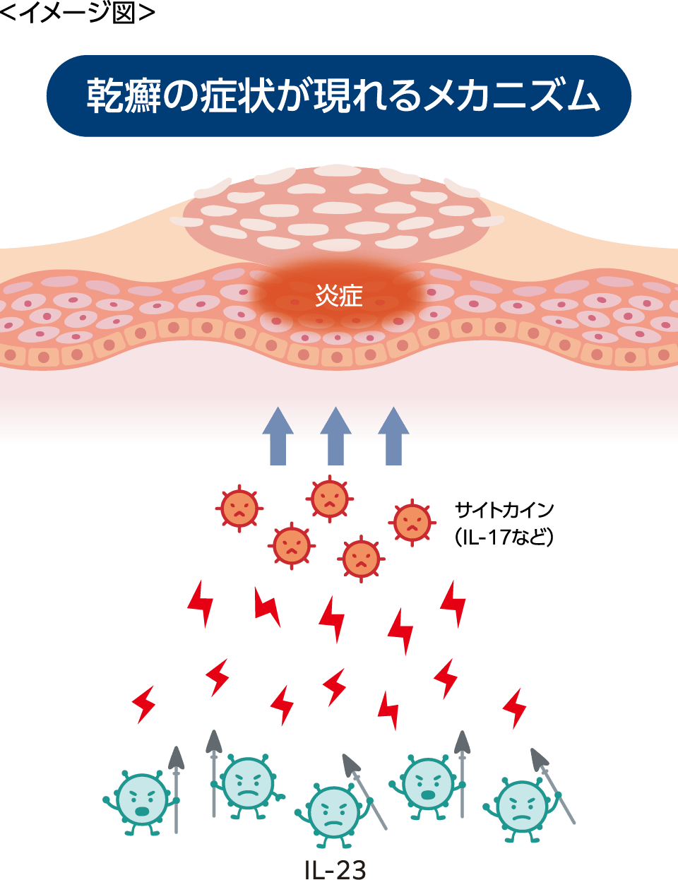 皮膚の下で何が起きているの？
