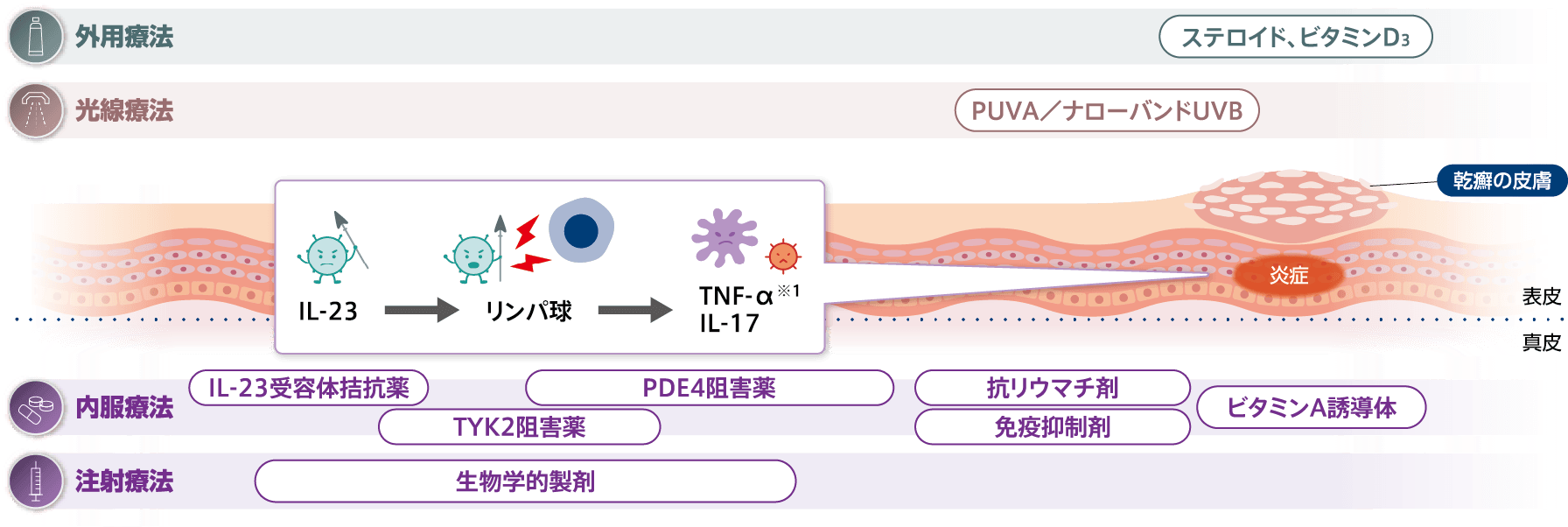 乾癬にはどんな治療法がある？