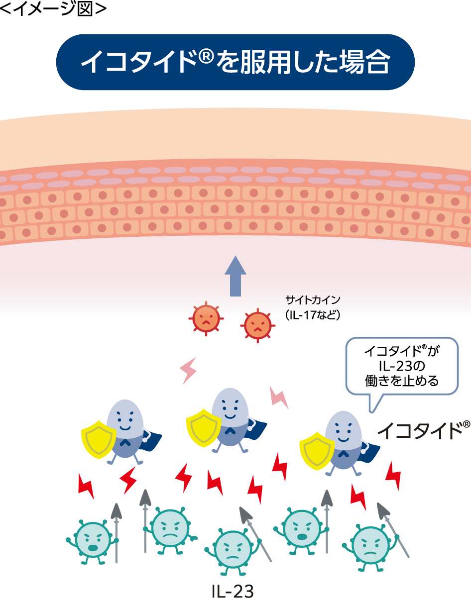 イコタイド®ってどんな薬？